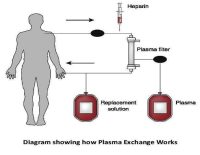 plasma