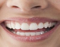 natural ways to whiten your teeth