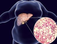 chronic diseases